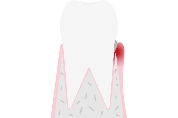 이미지명