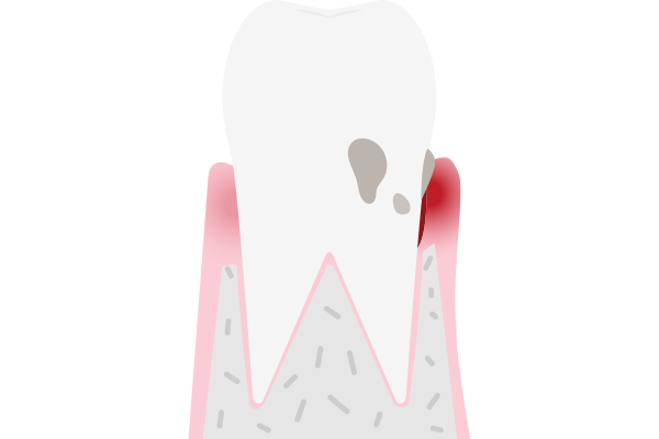 이미지명