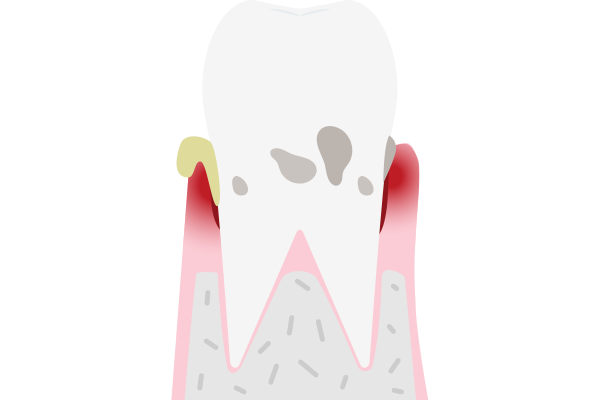 이미지명